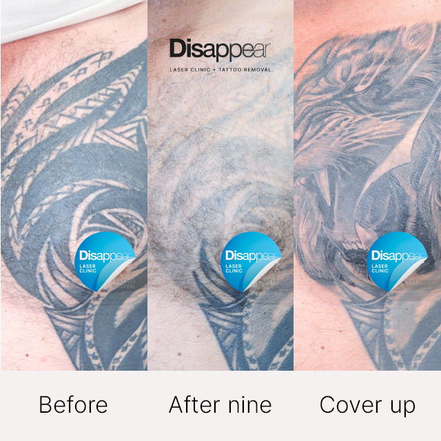 Fading For A Cover Up